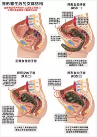 [REDPIG1] Yixing Nulang | 异形女郎 [Chinese]